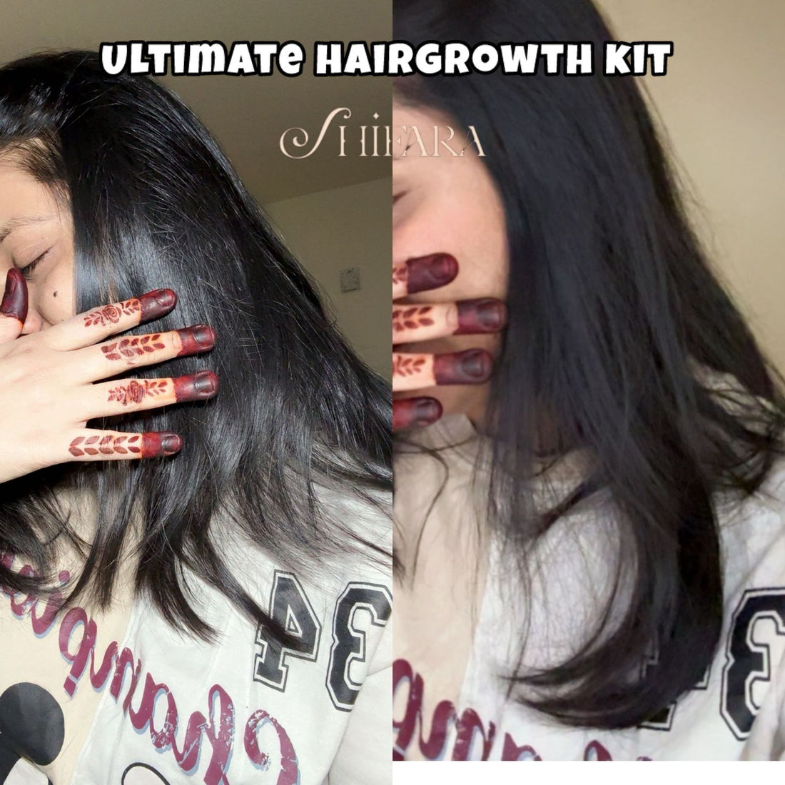 Ultimate Hair Growth Kit – Real Hair Regrowth in Just 1.5 Months