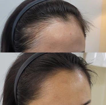 Ultimate Hair Growth Kit